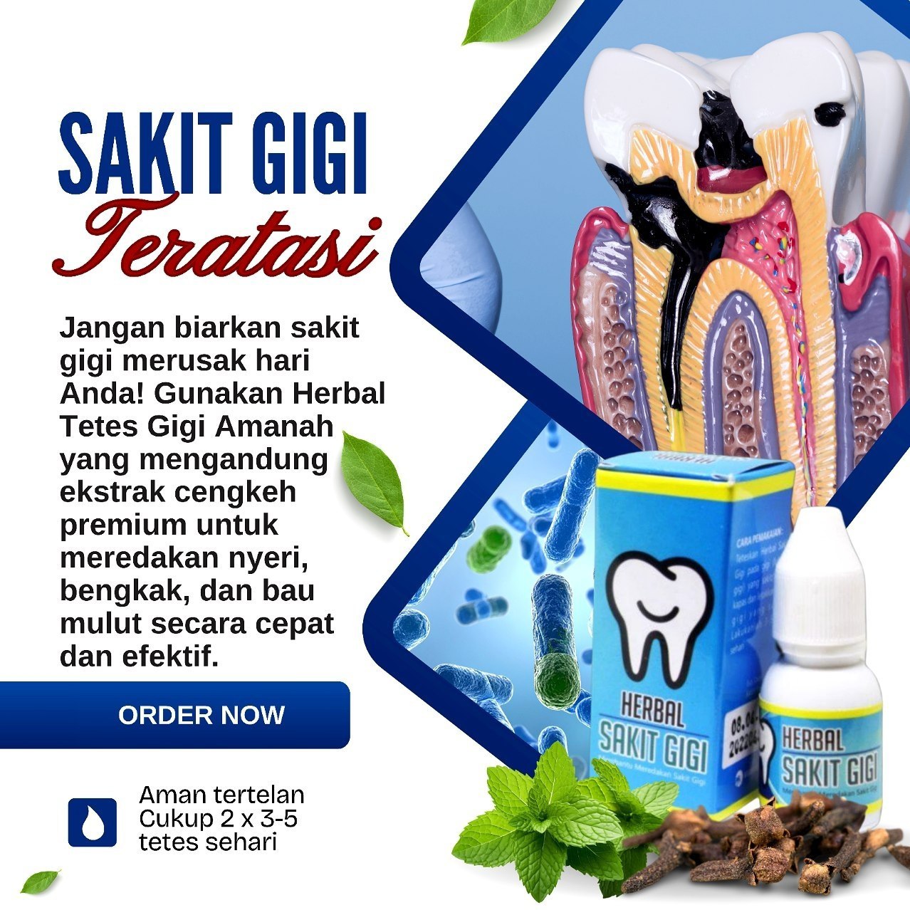 Sakit Gigi