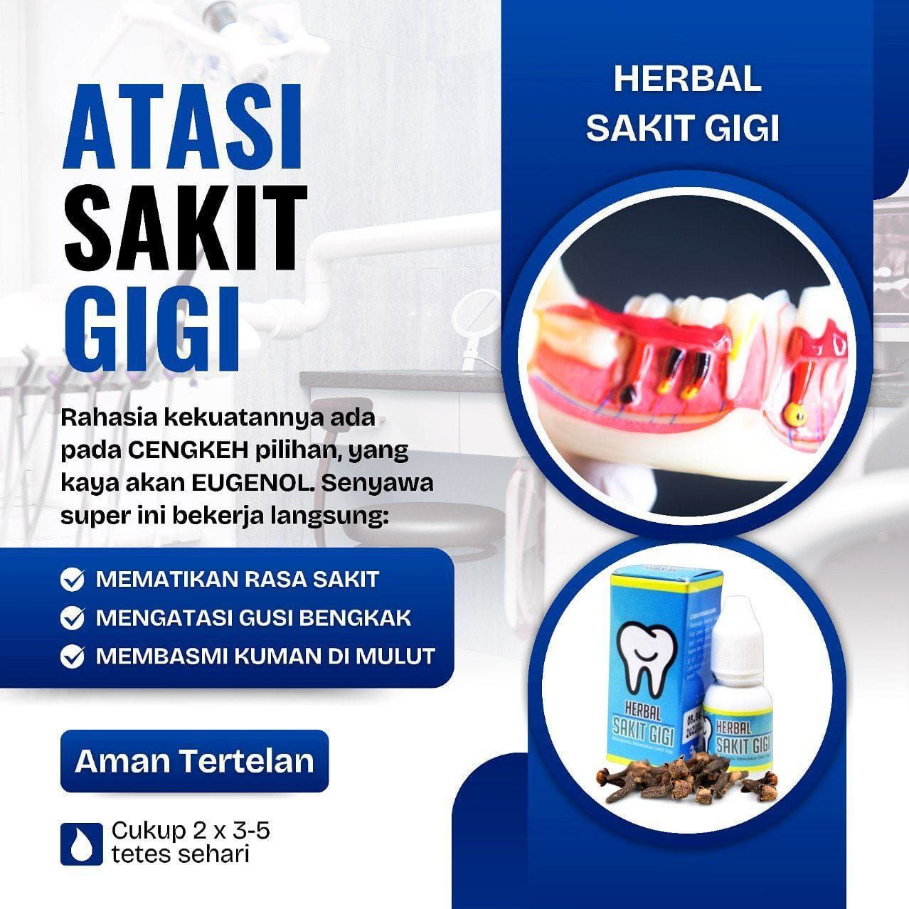 Sakit Gigi